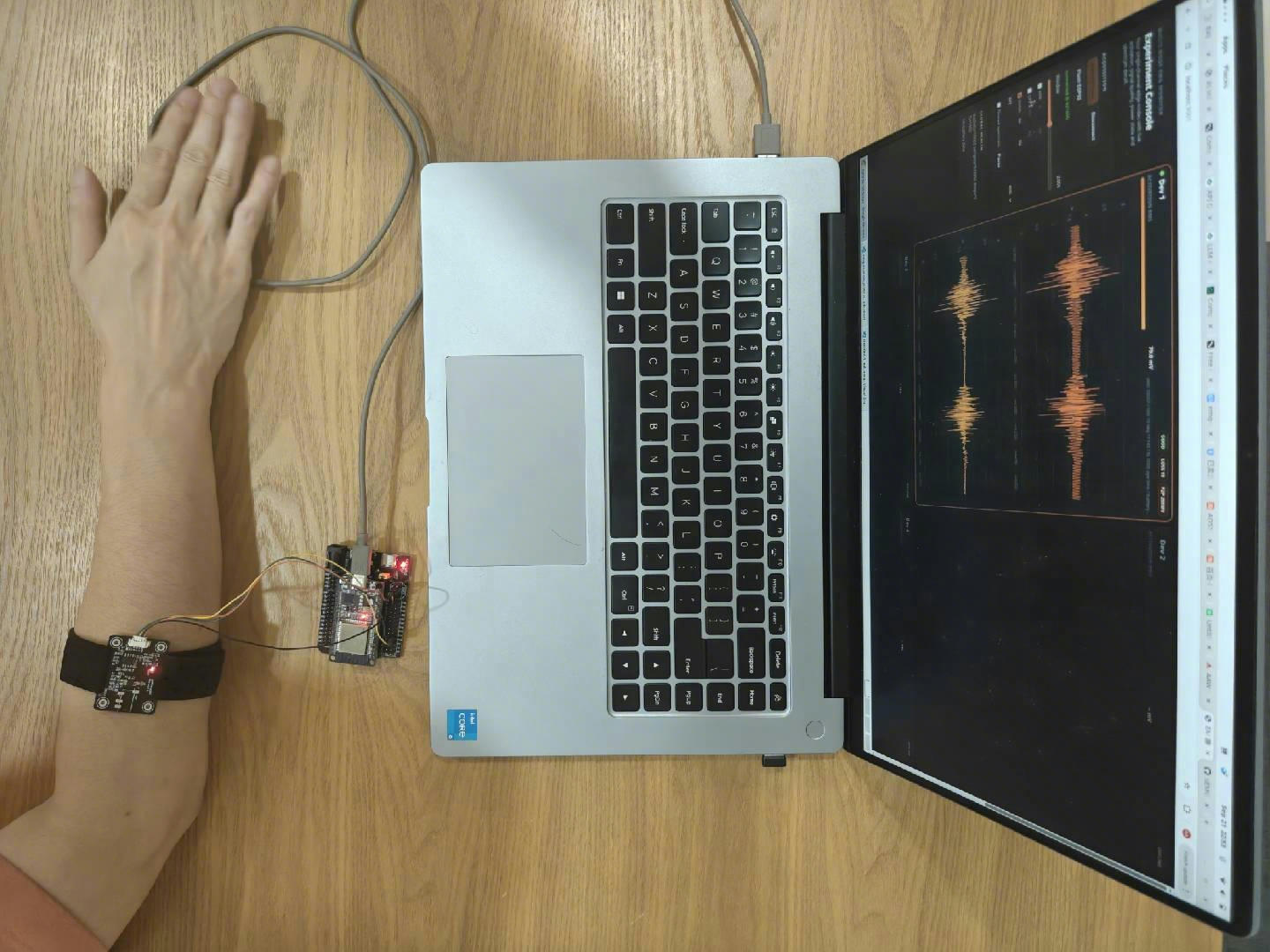 AAW sEMG Flex connected to an ESP32 DevKit and laptop waveform display